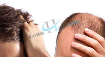 Hair Fixing - Hair Fixing Cost - Hair Fixing Clinic or Centre in Rohtak Hair Fixing - Hair Fixing Cost - Hair Fixing Clinic or Centre in Rohtak